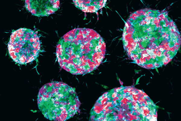 How tumor cells hijack healthy cells to promote metastasis