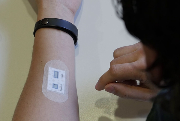 Self-powered, paper-based sweat detector for easy screening of cystic fibrosis