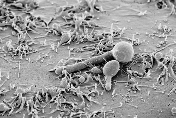 Parent of a deadly yeast pathogen found……. in the sea!