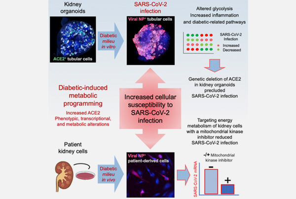 Diabetes opens the door to SARS-CoV-2 infection in the human kidney