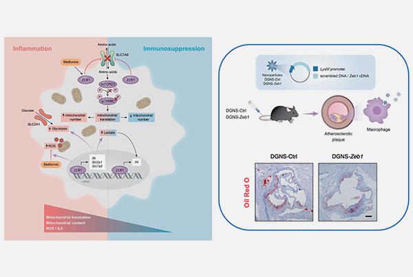 The Two Faces of ZEB1: A Tumor-Promoting Protein in Cancer Cells that Protects Against Inflammation in Macrophages