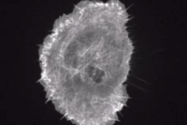 The (extracellular) matrix is viscous and it matters