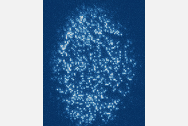 Imaging strontium superfluids atom by atom